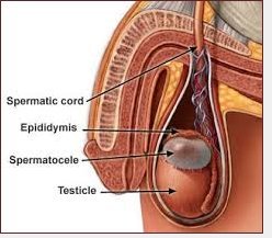 epidydimal cysts